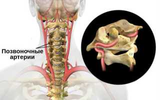 Позвоночные артерии
