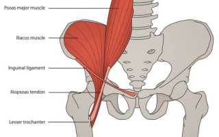 Где находится подвздошная мышца и почему болит?