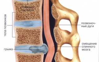 Что представляет собой дуральный мешок позвоночника?