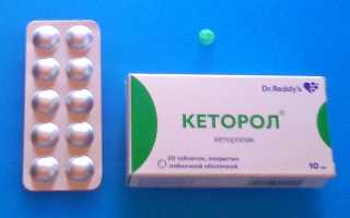 Кеторол (таблетки, гель, уколы) и его аналоги
