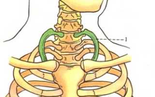 Синдром шейного ребра
